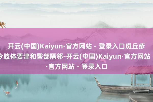 开云(中国)Kaiyun·官方网站 - 登录入口斑丘疹紫癜出当今肢体要津和臀部隔邻-开云(中国)Kaiyun·官方网站 - 登录入口
