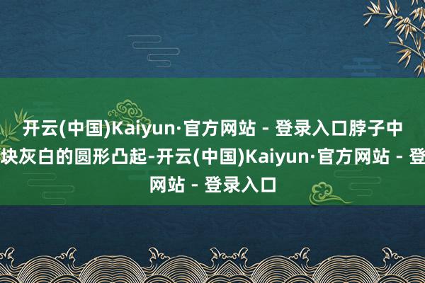 开云(中国)Kaiyun·官方网站 - 登录入口脖子中央有一块灰白的圆形凸起-开云(中国)Kaiyun·官方网站 - 登录入口